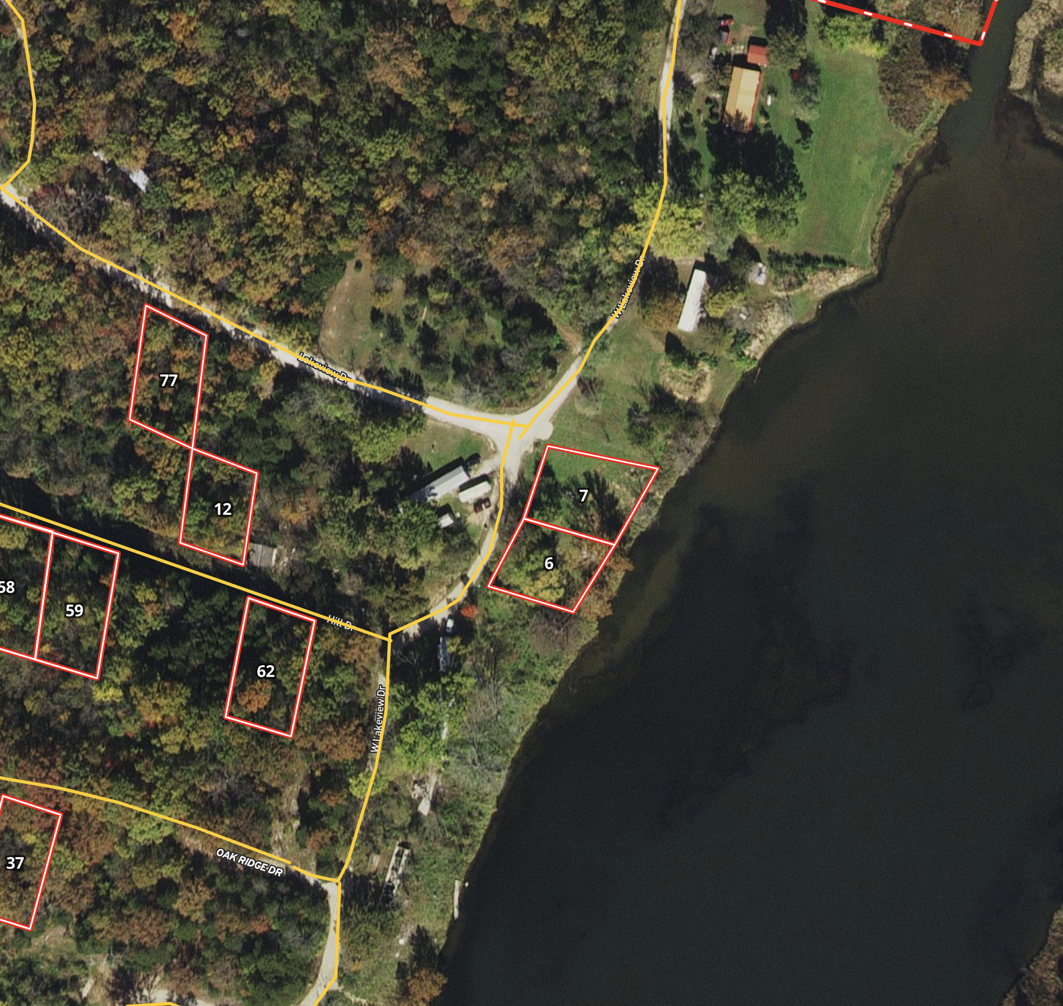 SPL-P3-T7 tract image